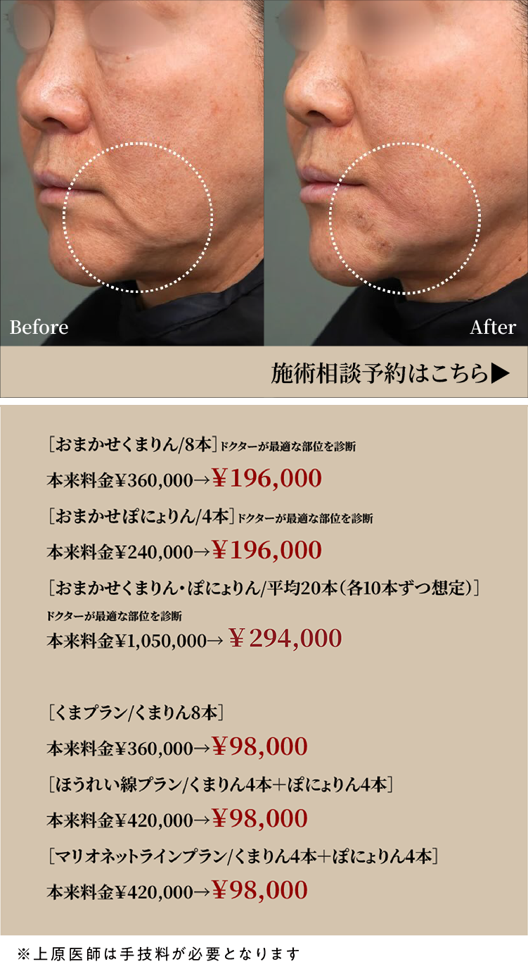 おまかせくまりん・ぽにょりん