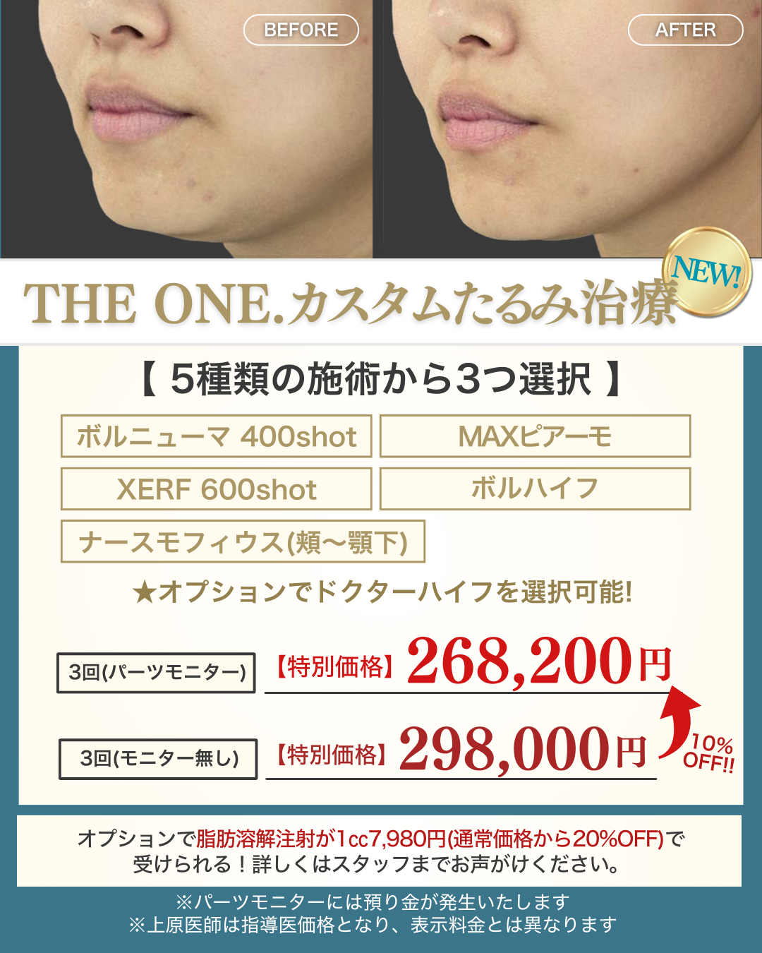 2月キャンペーン