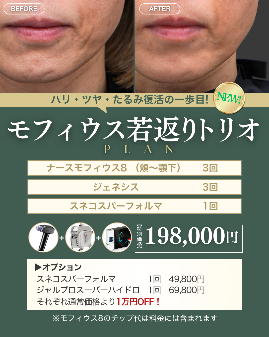 2月キャンペーン