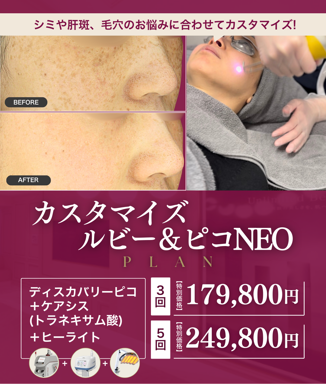 2月キャンペーン