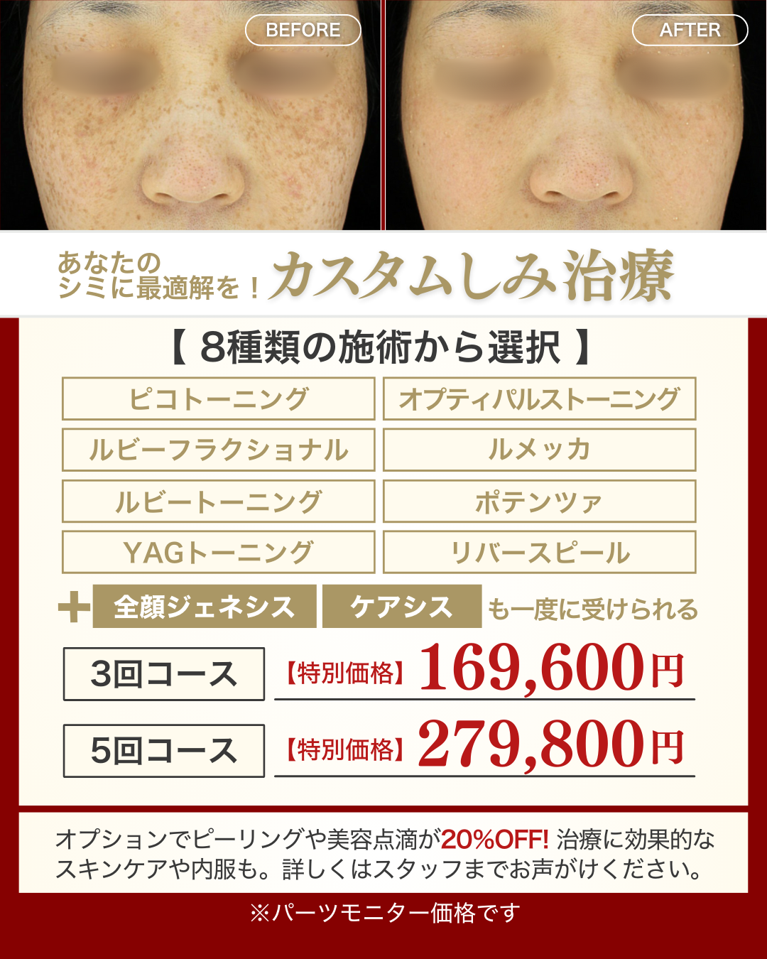 2月キャンペーン