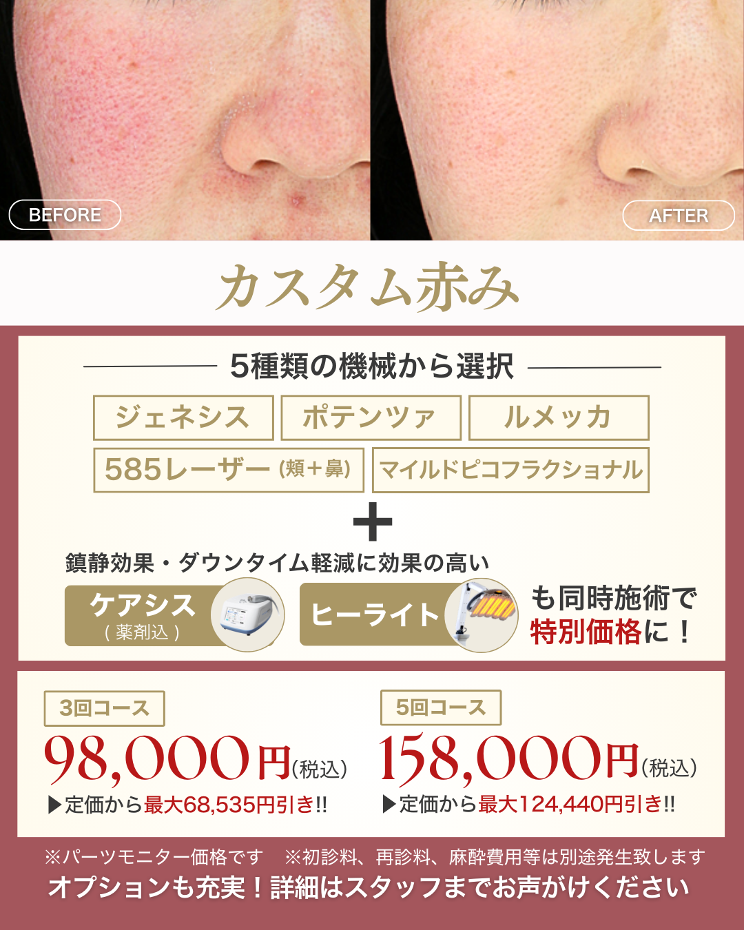 2月キャンペーン