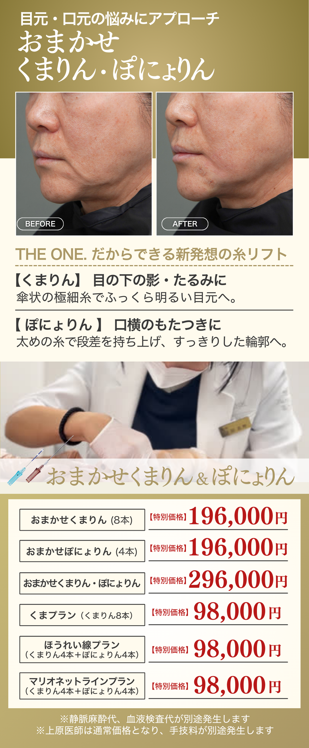 2月キャンペーン