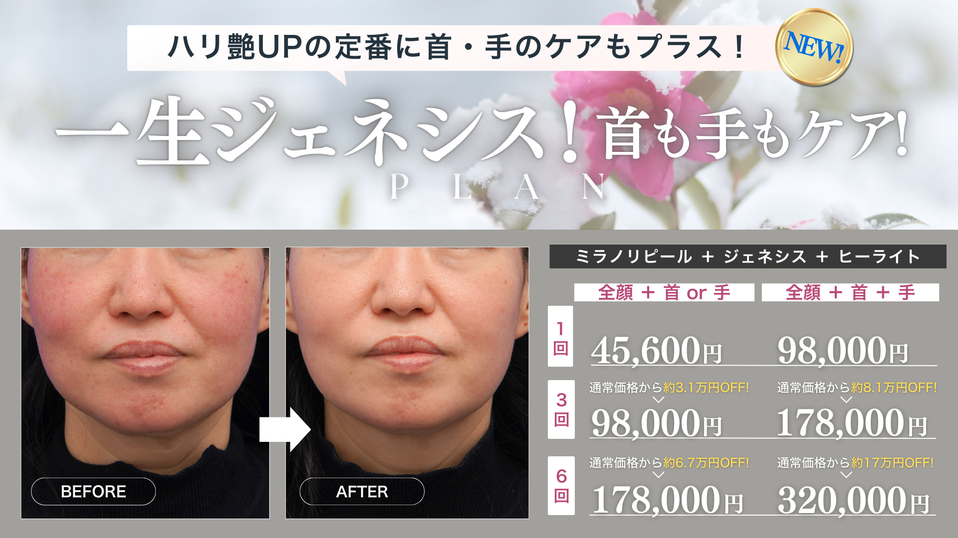 1月キャンペーン