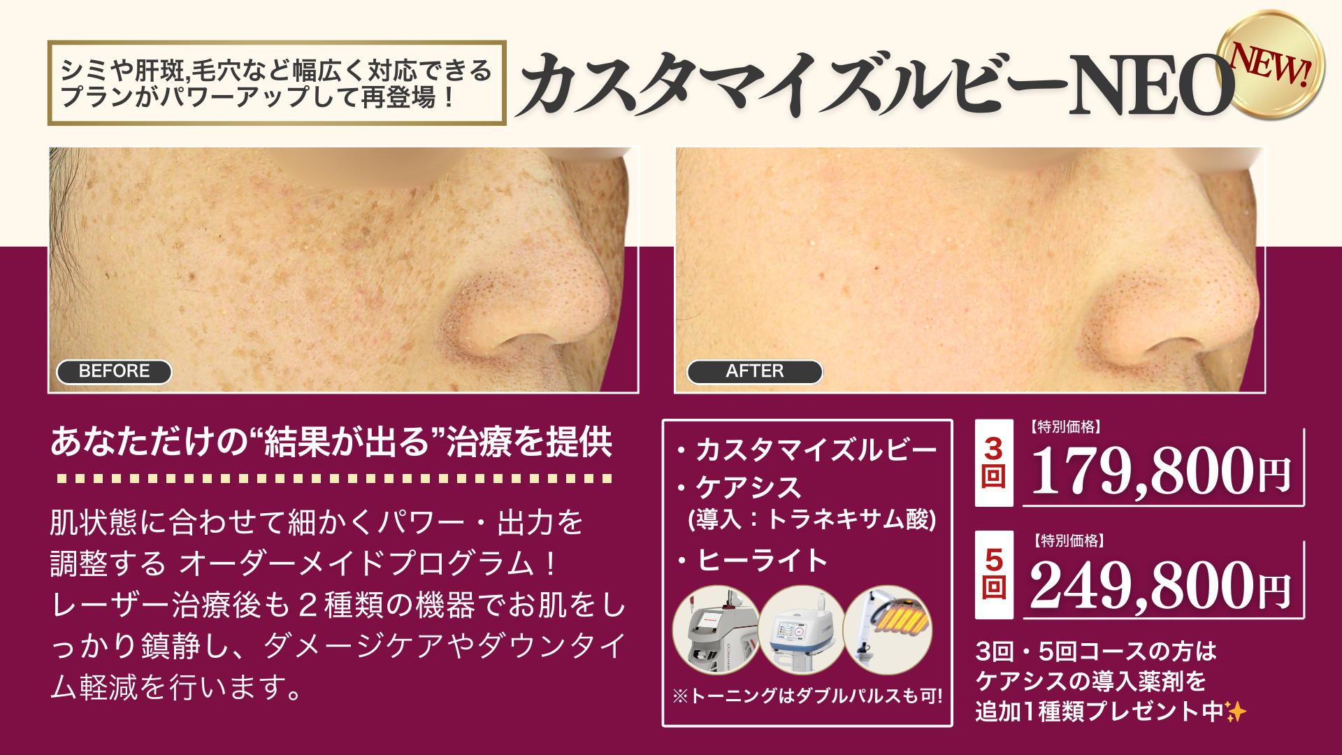 1月キャンペーン