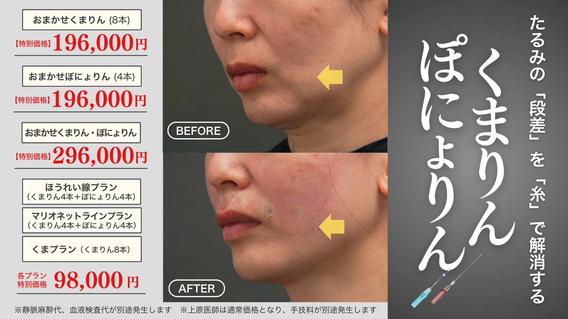 1月キャンペーン