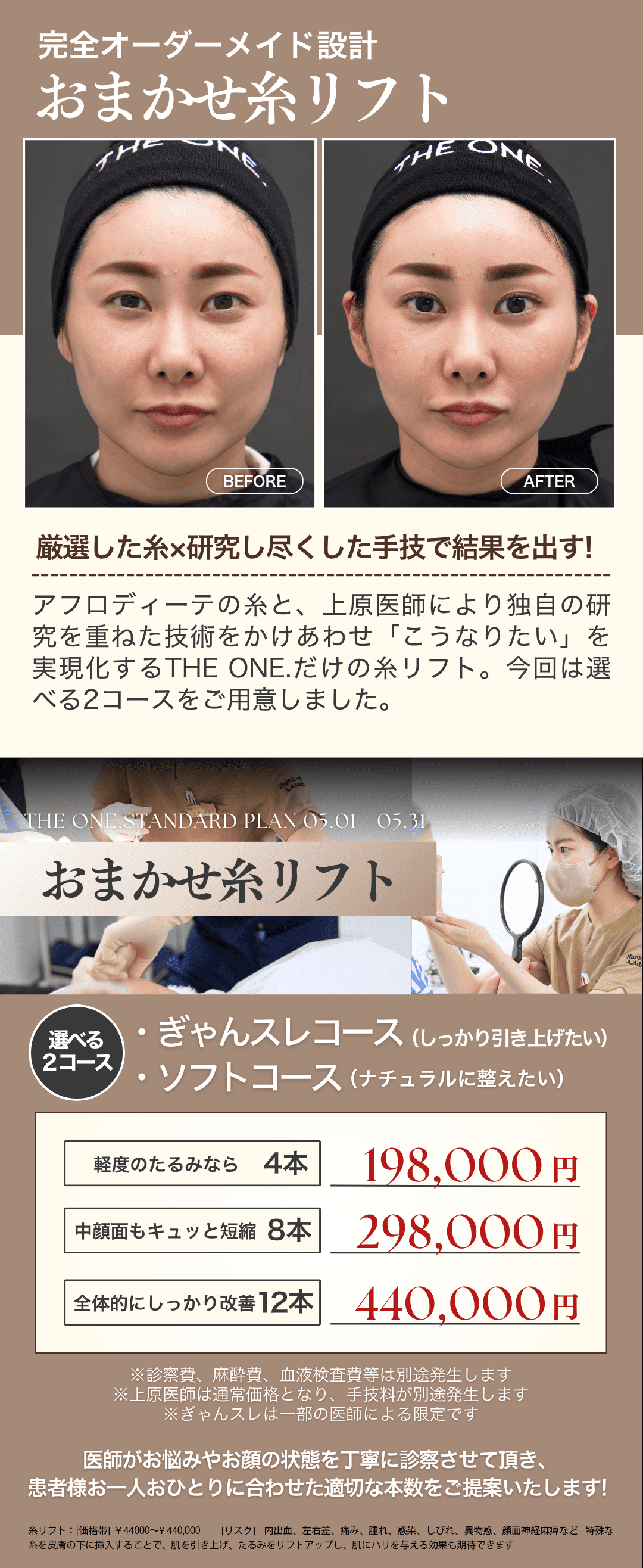 おまかせ糸リフト