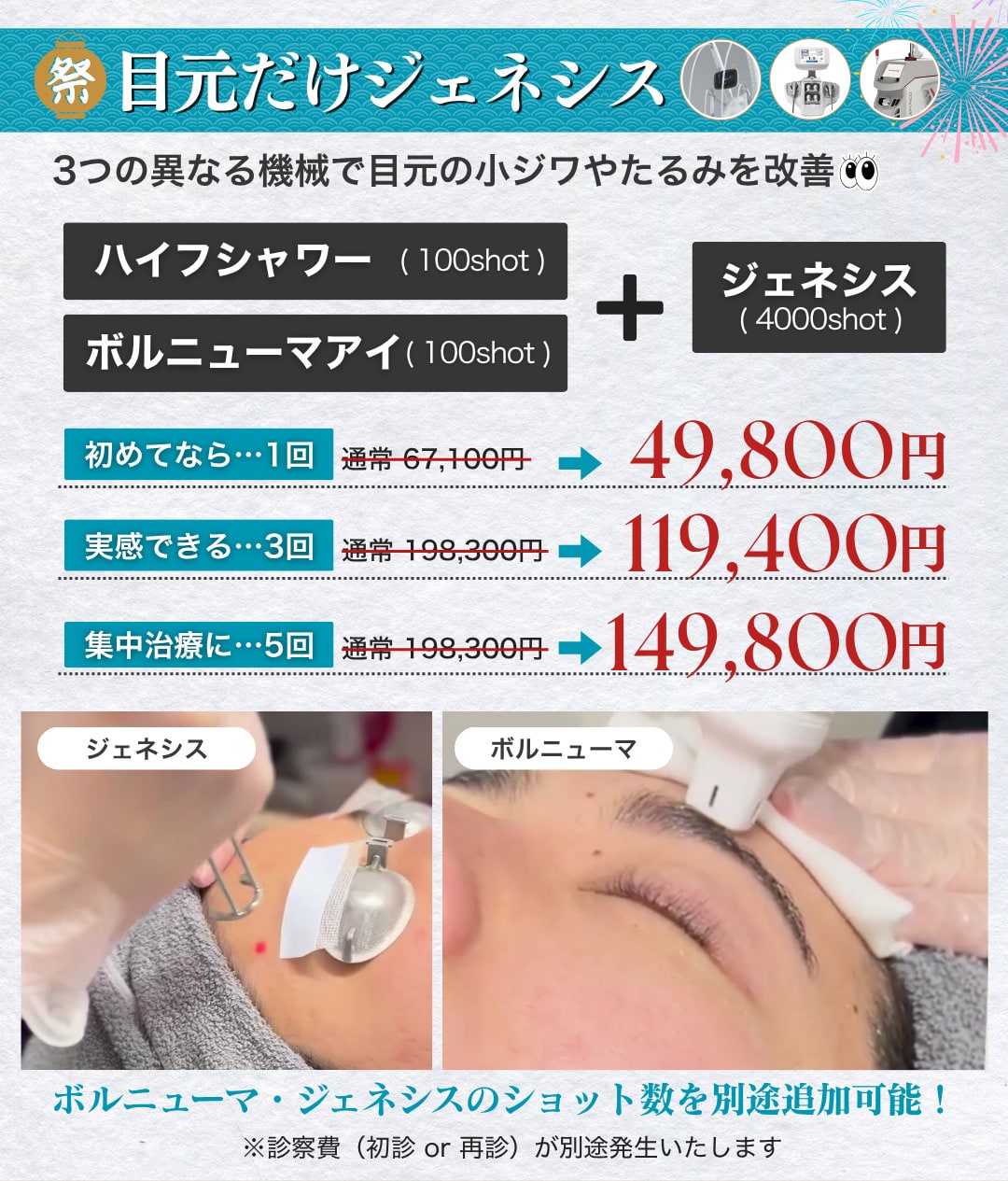 目元だけジェネシス
