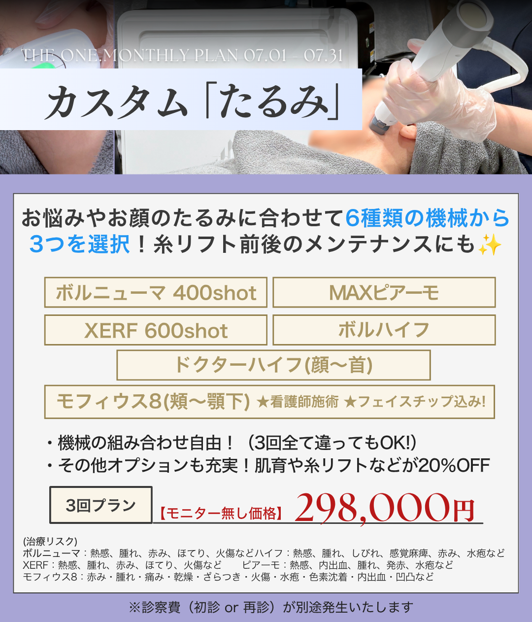 カスタムたるみ