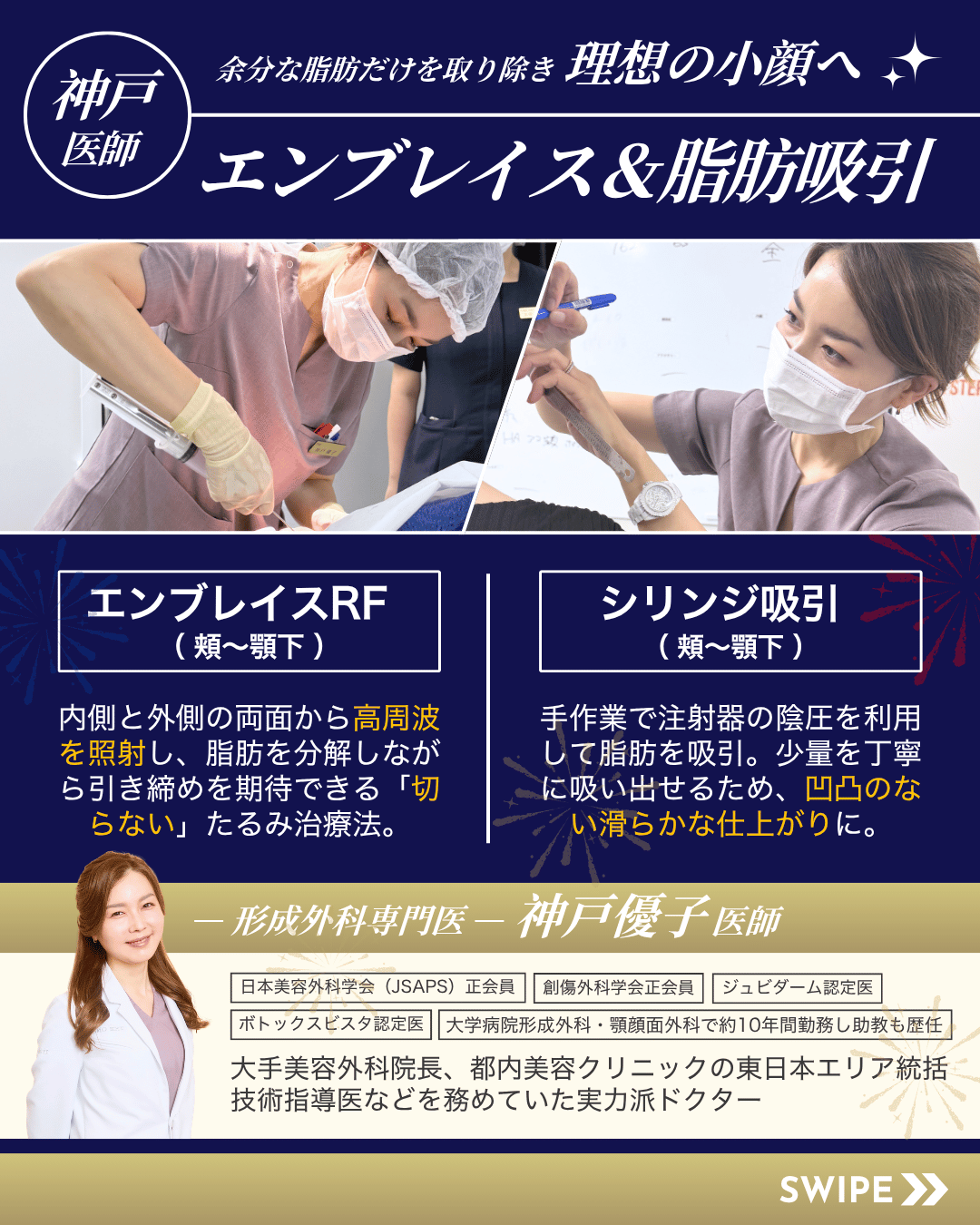 神戸医師エンブレイス脂肪吸引