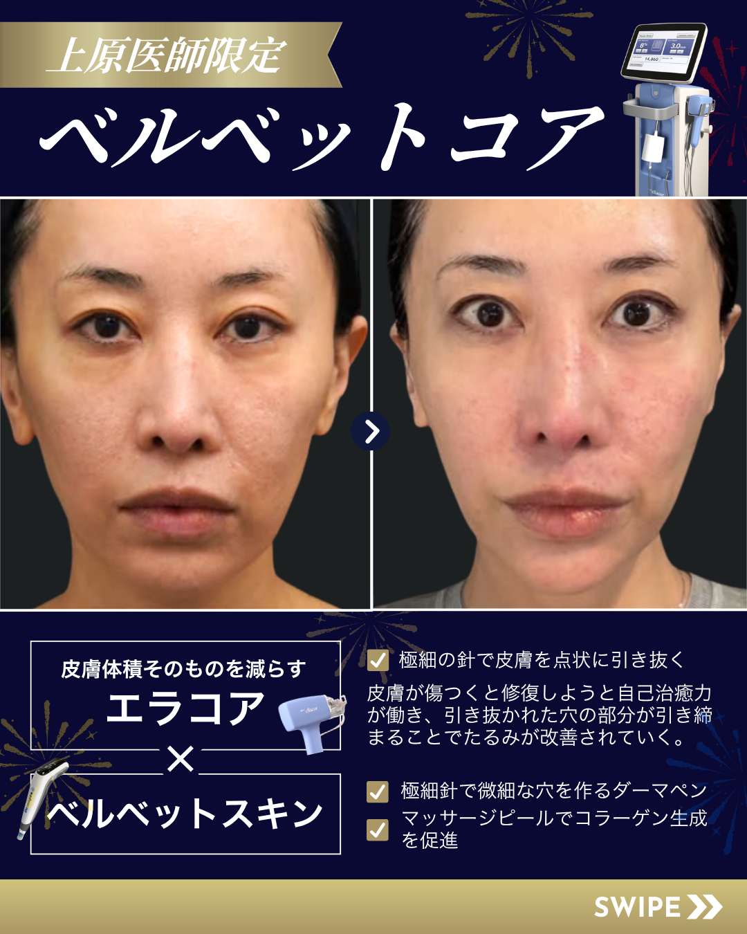 上原医師ベルベットコア