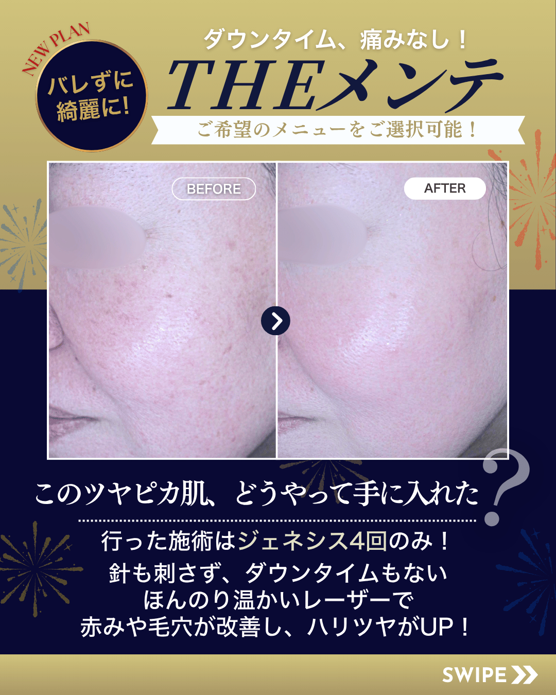 THEメンテ