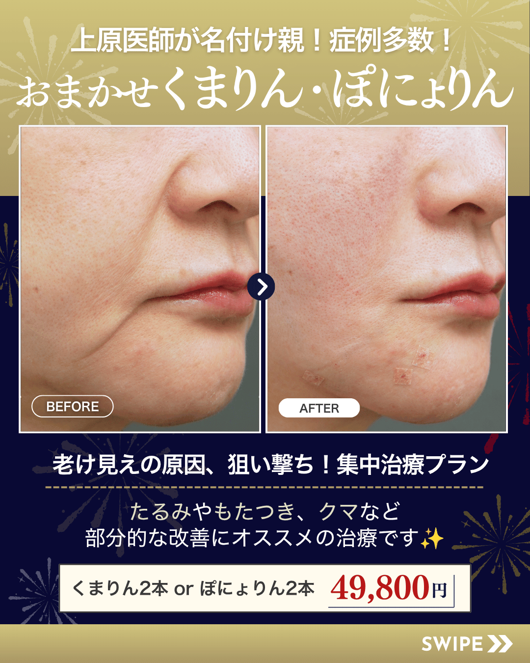おまかせくまりん・ぽにょりん