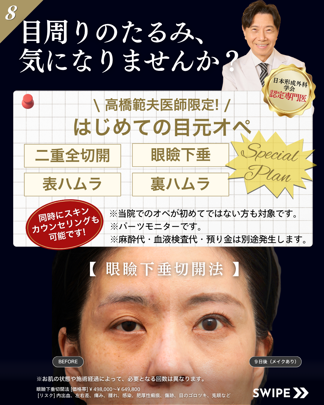 はじめての目元オペ